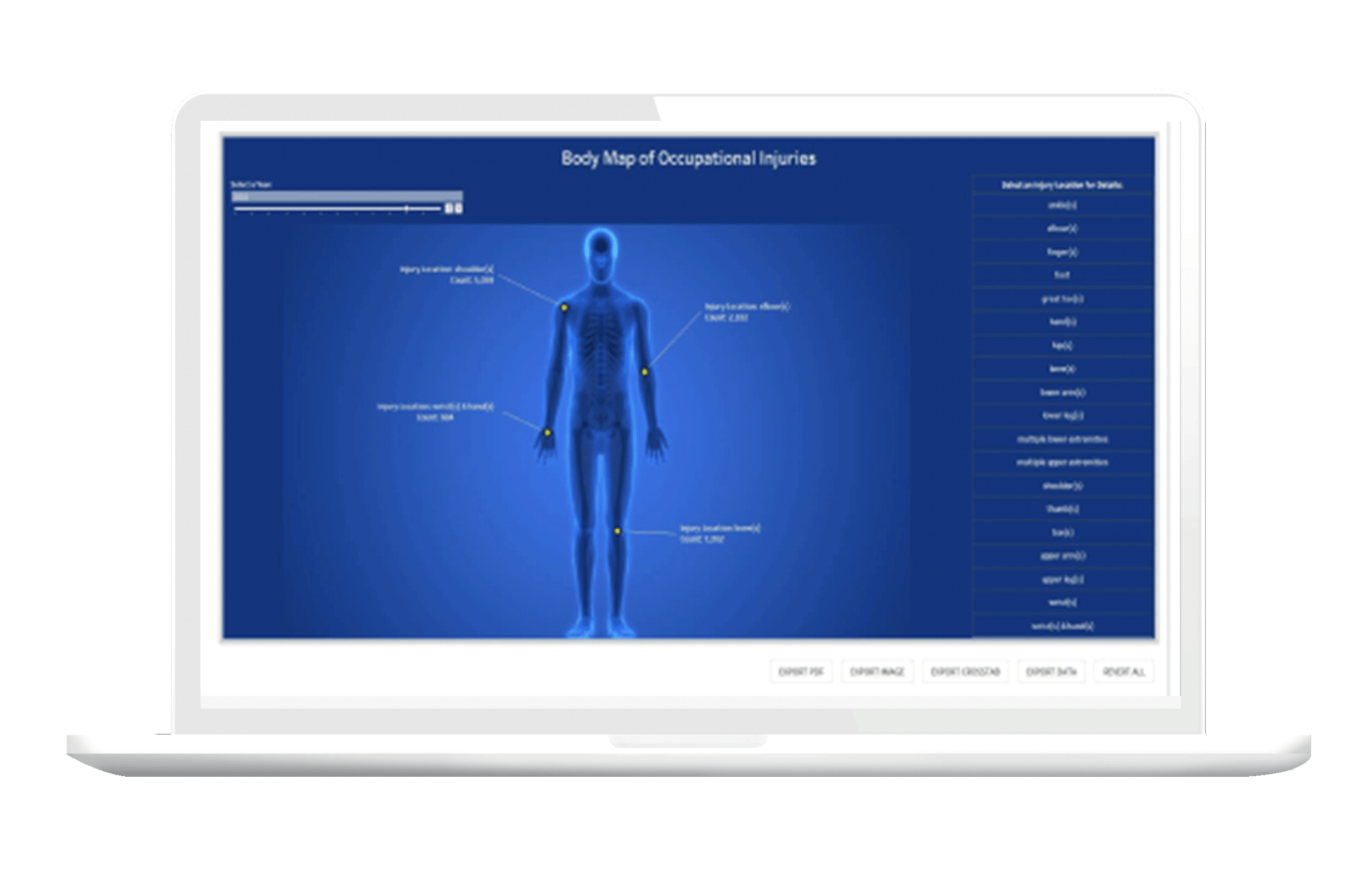 etq reliance EHS occupational injuries screen identifying employee injuries at work for health and safety management